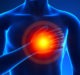 How AI can accurately identify reasons for an irregular heartbeat