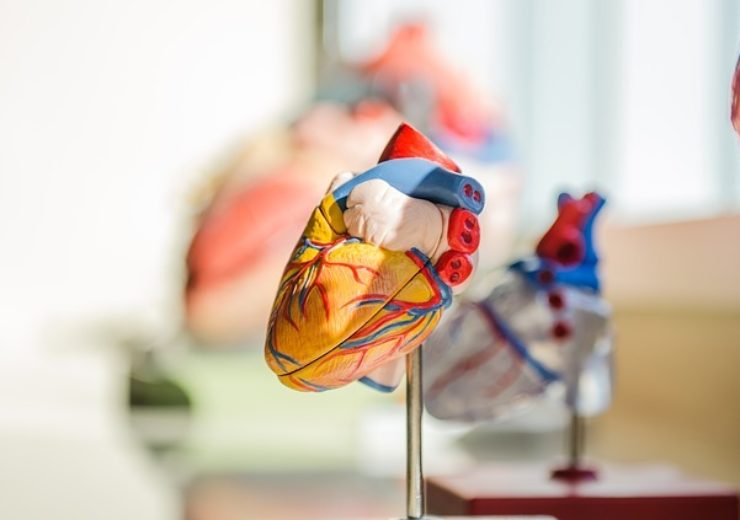 Terason and DiA Imaging Analysis partner to bring AI-based cardiac solutions