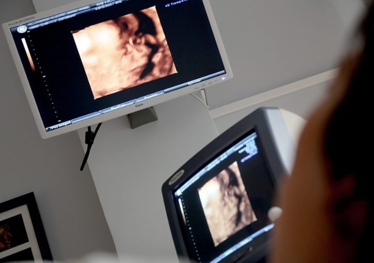 Exo Imaging secures £28m funding to advance ultrasound platform development