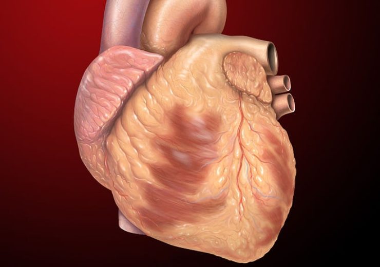 CARMAT secures FDA conditional approval for total artificial heart study