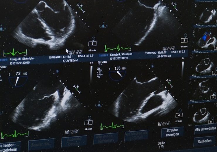 FUJIFILM SonoSite taps Allen Institute of Artificial Intelligence Incubator to interpret ultrasound images with AI