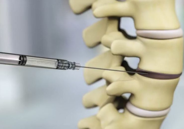 DiscGenics to start clinical trial of IDCT for degenerative disc disease patients