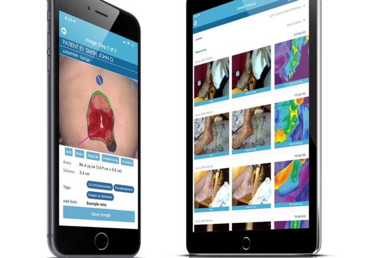 WoundVision introduces mobile app for wound management