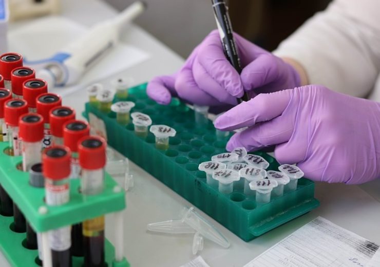 Sherlock Biosciences, Mologic to develop instrument-free molecular diagnostic tests