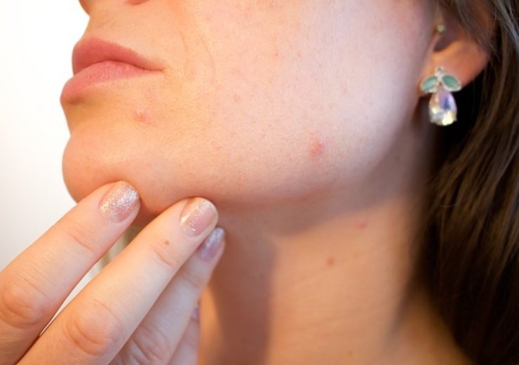 Sebacia unveils results from EU, US studies of Sebacia Microparticles for acne