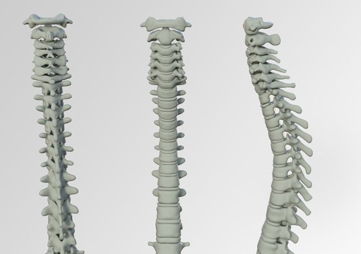 Synaptive Medical expands availability of Modus V into Spine Market
