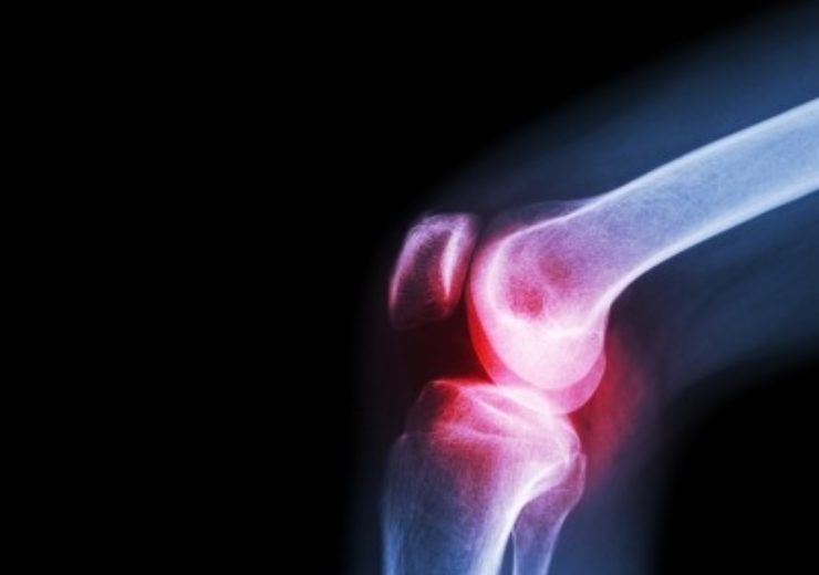 New research shows benefits of Exactech knee and shoulder joint replacement innovations