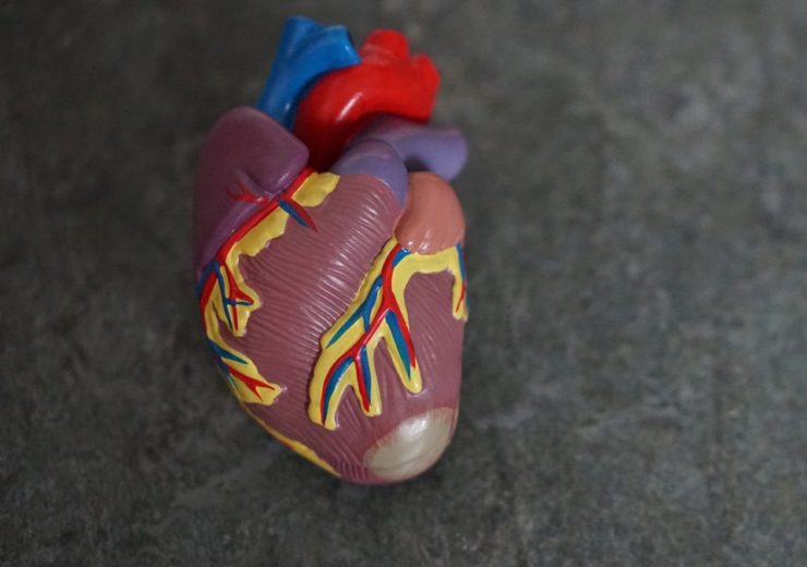 Novoheart, AstraZeneca to develop heart-in-a-jar model of heart failure