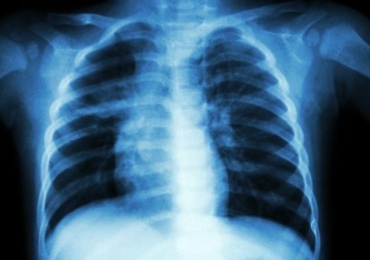 FDA approves QFT-Plus test on LIAISON platforms to detect tuberculosis