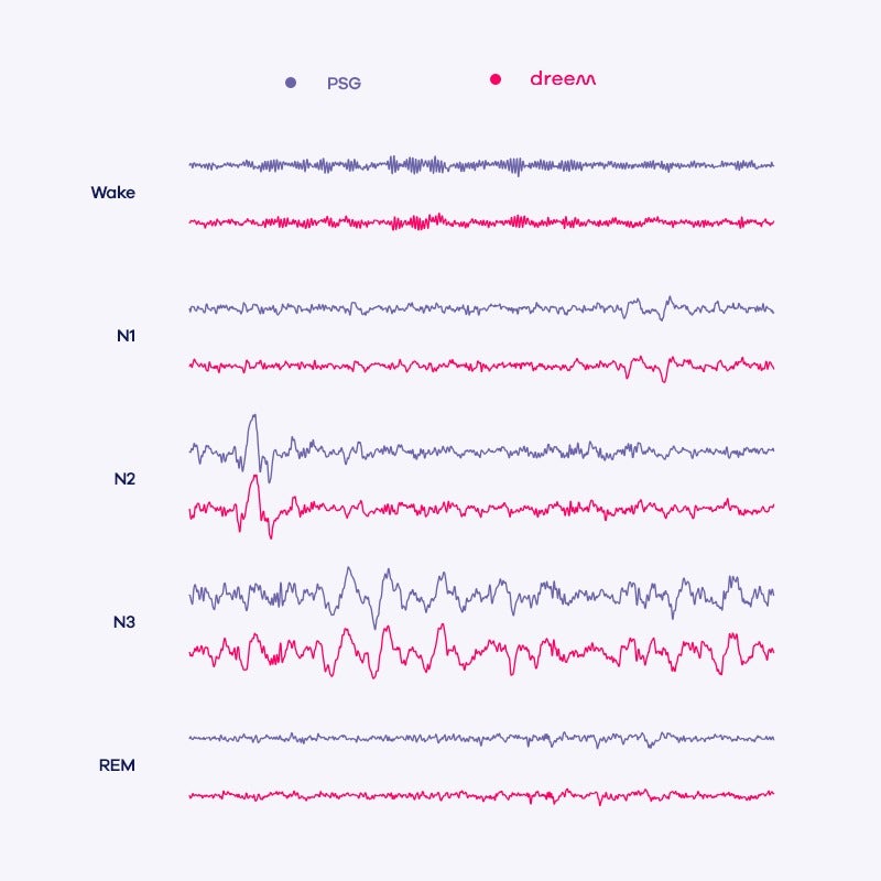 sleep monitoring