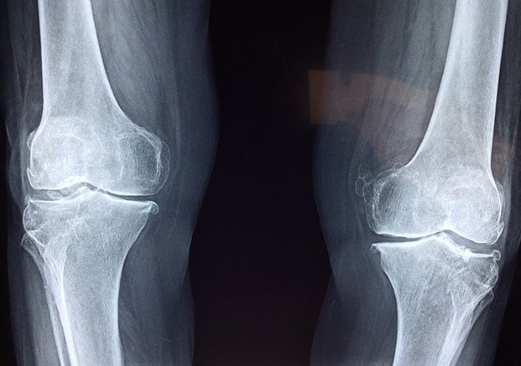 THINK Surgical and MCRA secure FDA approval for Total Knee Replacement Technology