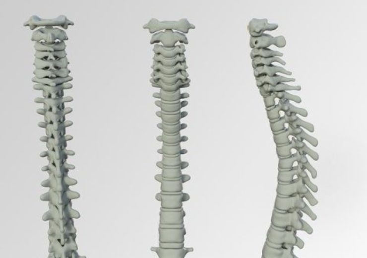 Life Spine announces first cases with CENTERLINE Modular Thoracolumbar spinal system