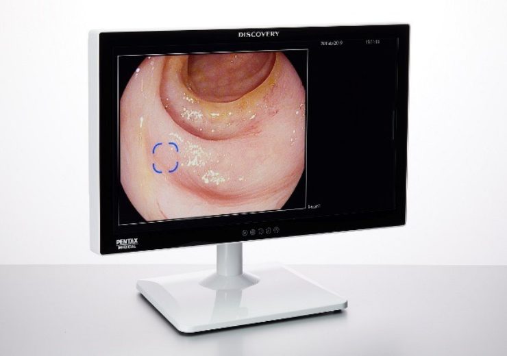 Pentax Medical gets CE mark for Discovery AI assisted polyp detector