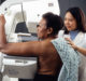 In favour of mammography: Study involving 50,000 women shows importance of scans in breast cancer diagnosis