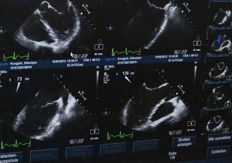 Terason, AmCad BioMed collaborate on ultrasound imaging technology