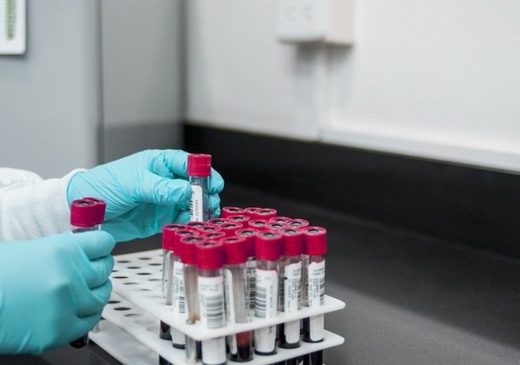Sebia Enters Into Agreement With Sanofi To Develop Multiple Myeloma Diagnostic Test NS Medical