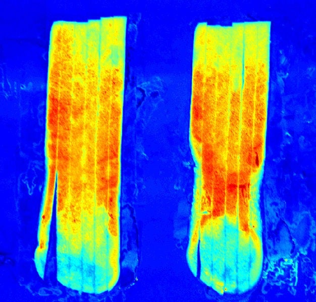 biophotonics hyperspectral imaging