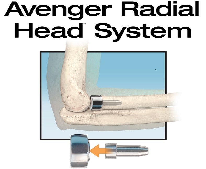 In2Bones launches Avenger system for radial head replacement surgery in US