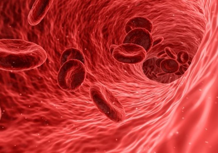 Zynex Obtains European Patent for Blood Volume Monitor