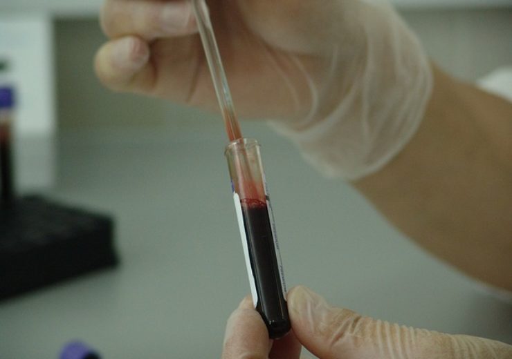 BD, Babson Diagnostics collaborate on small-volume blood collection