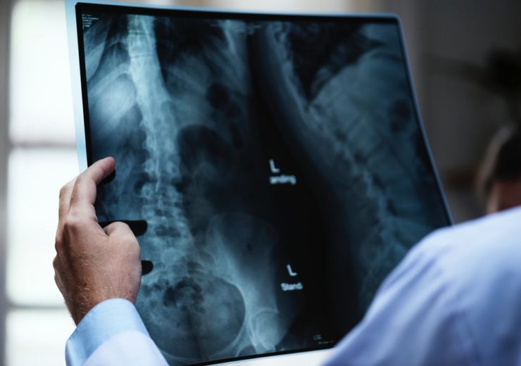 UK government invests £81m in technology to create 40-second X-rays