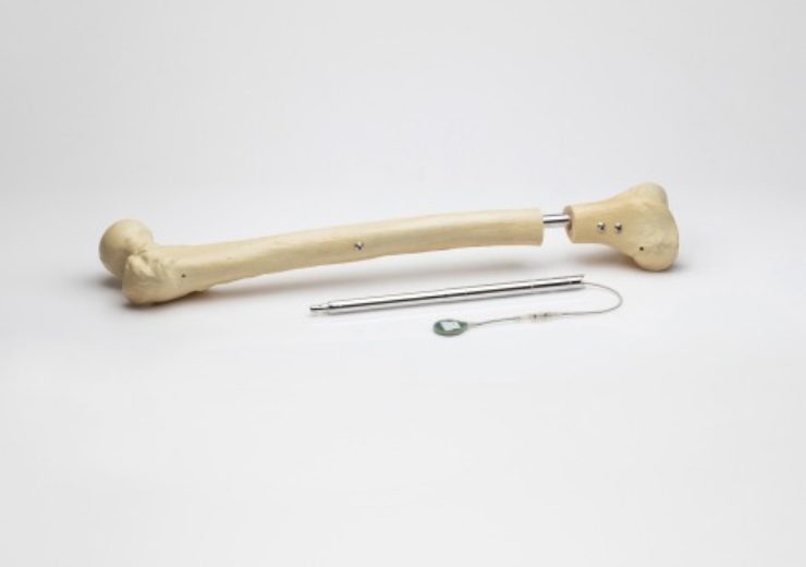 Orthofix completes acquisition of FITBONE limb lengthening system