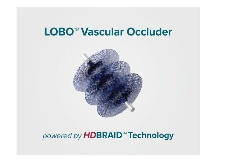 Okami Medical announces first patients treated with LOBO vascular occluder