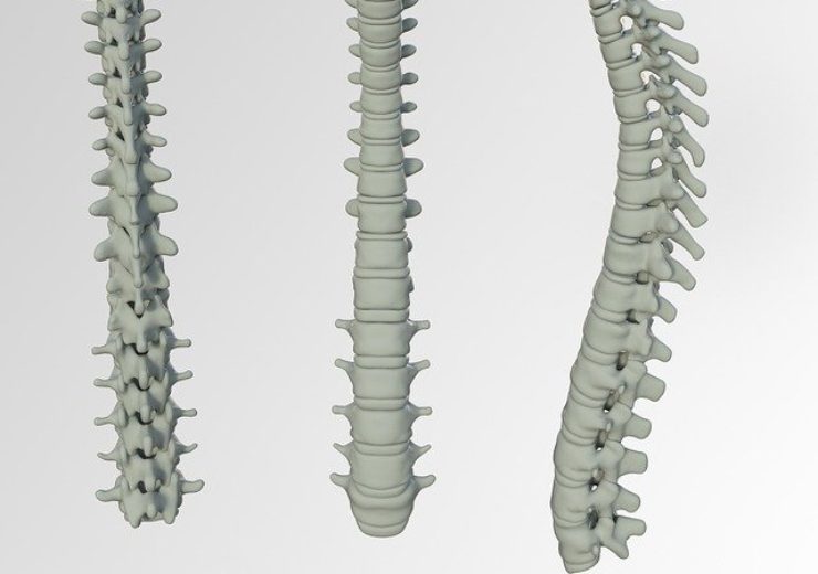 Precision Spine introduces SureLOK MIS 3L percutaneous screw system in US
