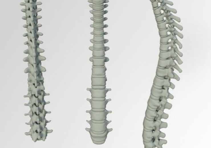 Life Spine grows expandable portfolio with secondary FDA 510(k) of lateral PROLIFT expandable system