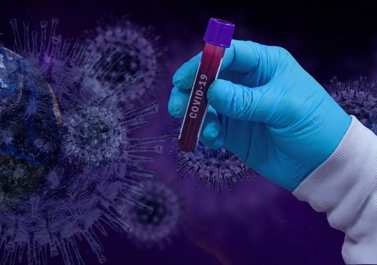 Roche develops new COVID-19 antibody serology test