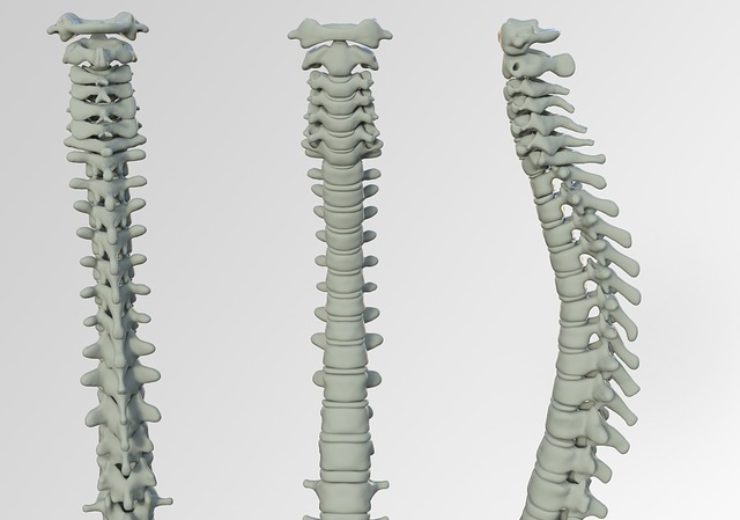 Precision Spine launches Reform MC Posterior Lumbar Fusion System