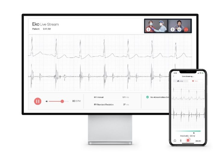 Eko launches first AI-powered telehealth platform for virtual pulmonary and cardiac exams, providing clinicians with in-person level exam capabilities during video visits