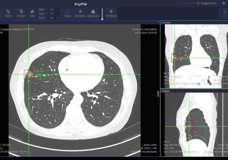 VUNO Med LungCT AI receives MFDS regulatory approval