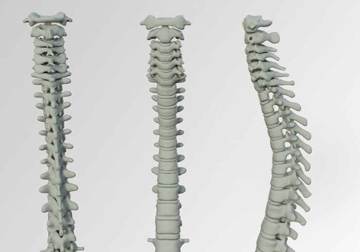 Precision Spine announces launch of Slimplicity HP Anterior Cervical Plating System
