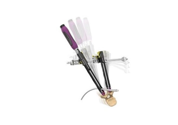 NuVasive introduces new Reline 3D posterior fixation system