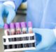 NuProbe and Weigao collaborate on developing liquid biopsy panel