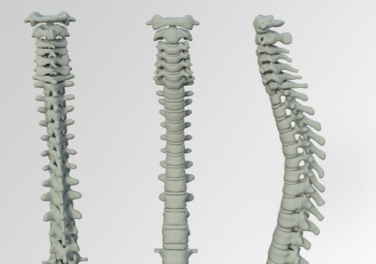 Spinal Elements introduces MIS Ultra Platform for spine surgery