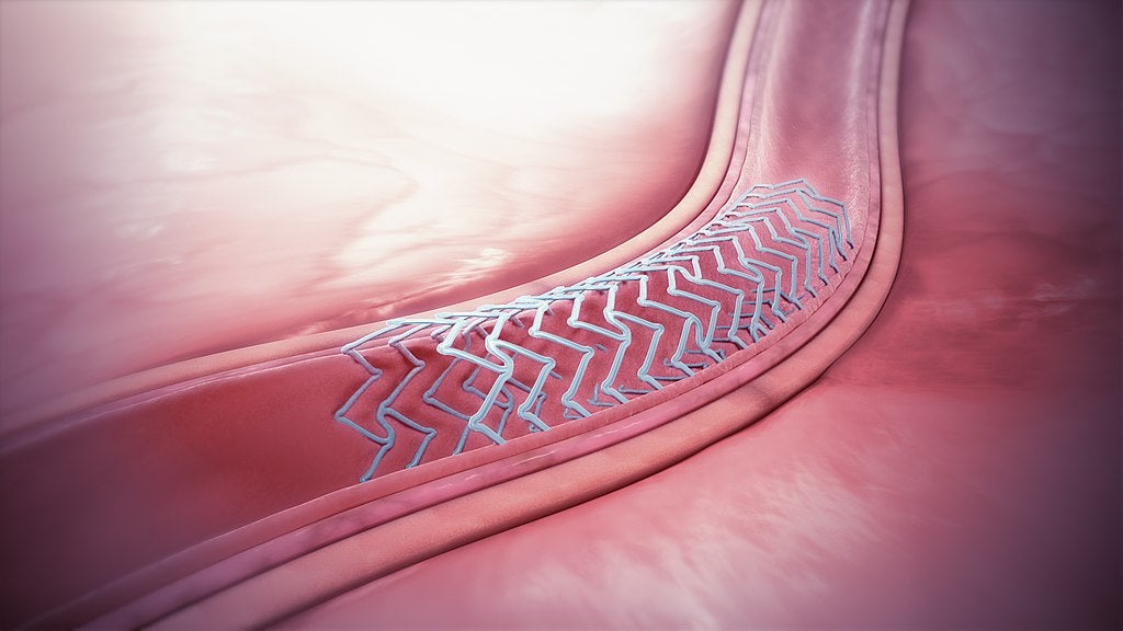 covid-19 medical device markets stent grafts