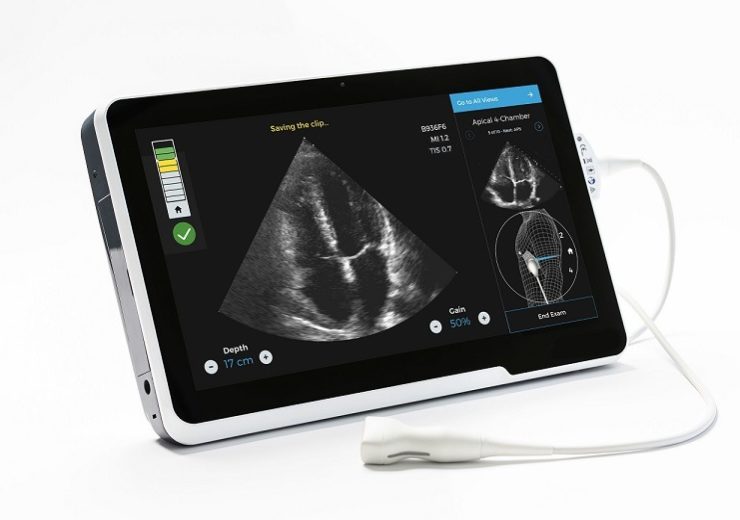 Caption Health raises $53m to develop AI-guided ultrasound technology