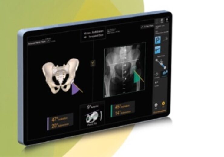 Smith+Nephew launches new RI.HIP NAVIGATION for total hip arthroplasty