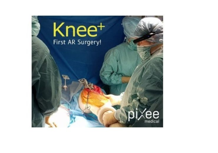 First knee replacement surgery successfully completed using Augmented Reality technology from Pixee Medical AR Knee+ and Vuzix M400 smart glasses