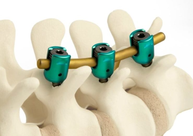 ulrich medical USA launches Momentum posterior spinal fixation system