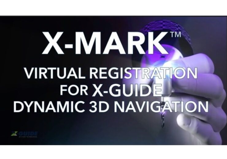 X-Nav Technologies gets FDA nod for X-Mark virtual patient registration technology