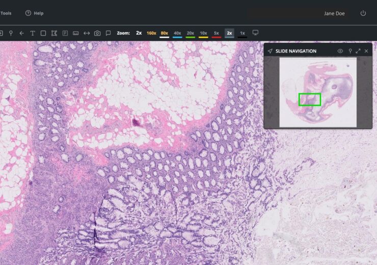 Paige wins FDA approval for FullFocus digital pathology image viewer