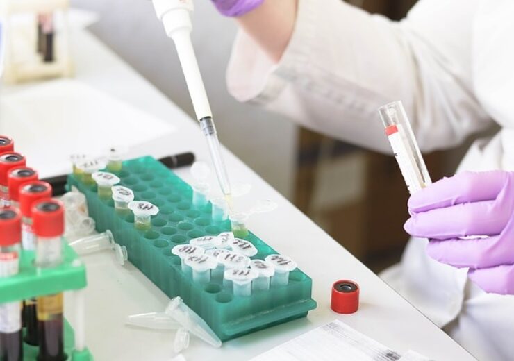 LabCorp gets FDA EUA for matrixed pooled Covid-19 testing