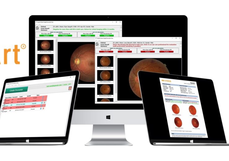 Eyenuk announces FDA Clearance for EyeArt autonomous ai system for diabetic retinopathy screening