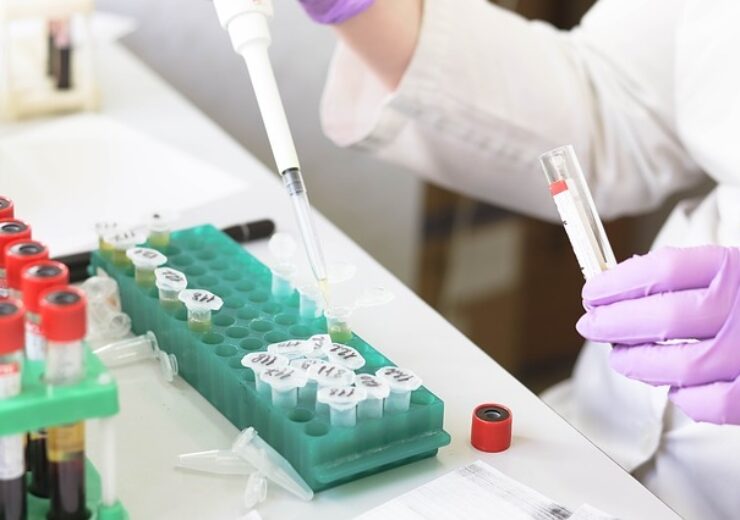 AnPac Bio validating approved Covid-19 antibody test