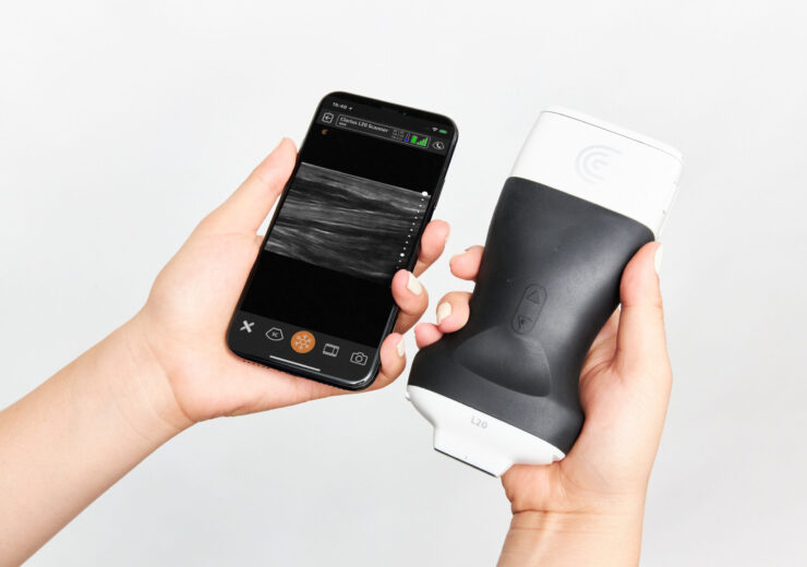 Clarius introduces the world’s first ultra-high frequency handheld ultrasound scanner