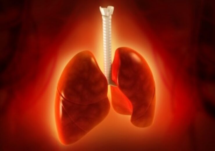 New non-invasive test for lung cancer available exclusively from LabCorp