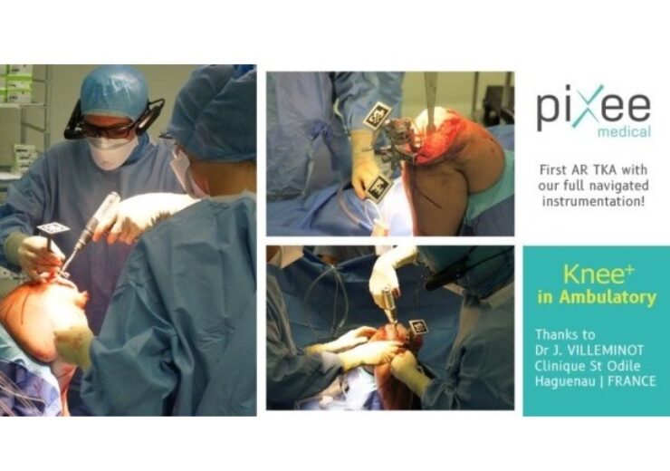Pixee Medical completes its first total knee replacement surgery guided solely by Vuzix M400 smart glasses